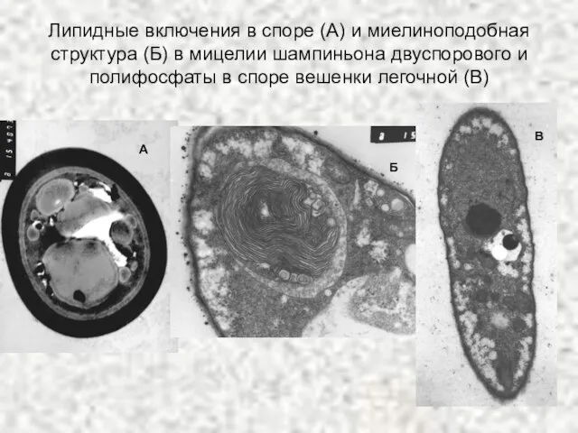 Липидные включения в споре (А) и миелиноподобная структура (Б) в мицелии шампиньона