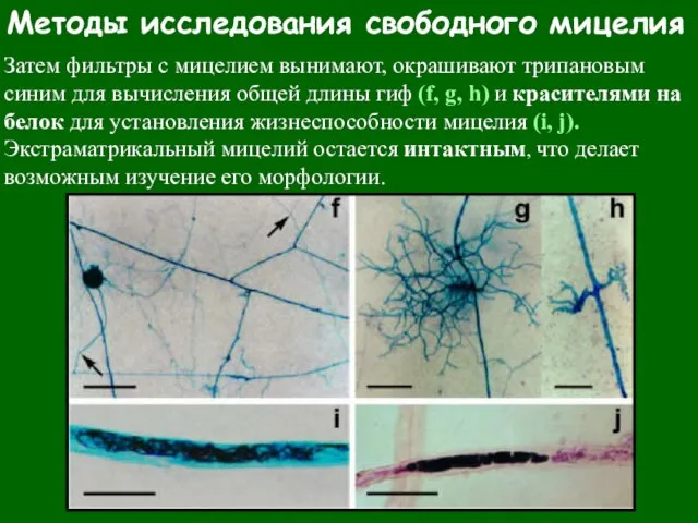 Методы исследования свободного мицелия Затем фильтры с мицелием вынимают, окрашивают трипановым синим