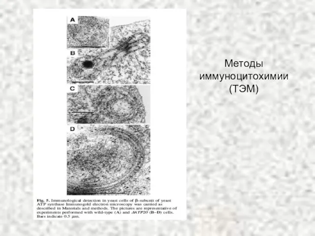 Методы иммуноцитохимии (ТЭМ)