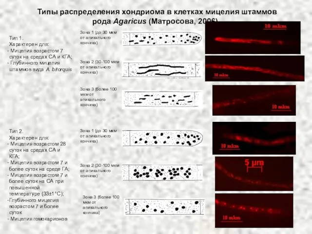 Типы распределения хондриома в клетках мицелия штаммов рода Agaricus (Матросова, 2006) .