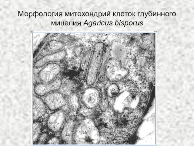 Морфология митохондрий клеток глубинного мицелия Agaricus bisporus