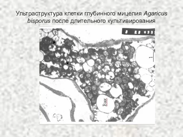 Ультраструктура клетки глубинного мицелия Agaricus bisporus после длительного культивирования