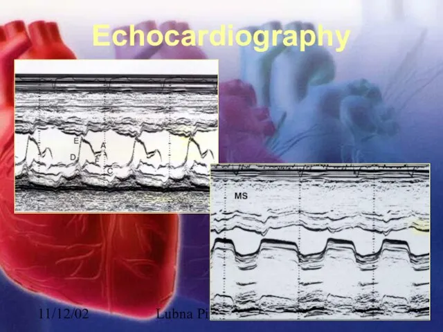 11/12/02 Lubna Piracha, D.O. Echocardiography