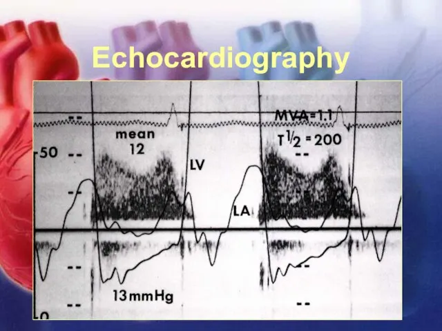 11/12/02 Lubna Piracha, D.O. Echocardiography