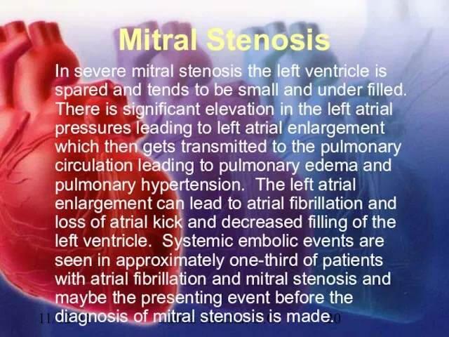 11/12/02 Lubna Piracha, D.O. Mitral Stenosis In severe mitral stenosis the left