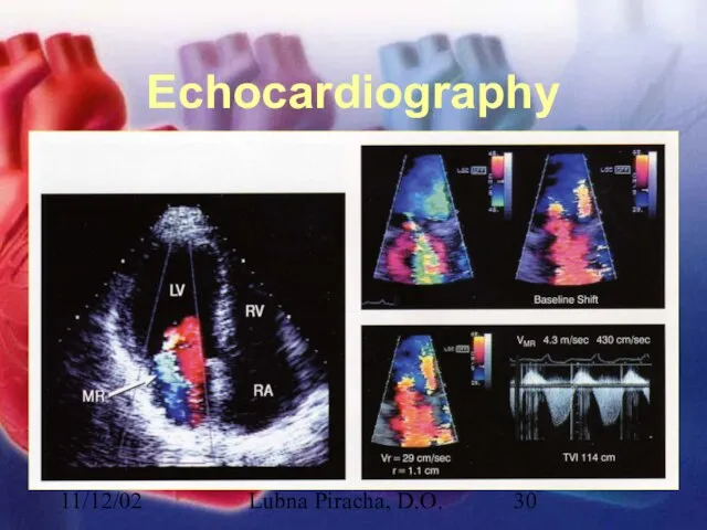 11/12/02 Lubna Piracha, D.O. Echocardiography