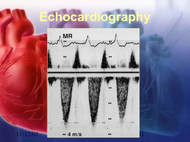 11/12/02 Lubna Piracha, D.O. Echocardiography