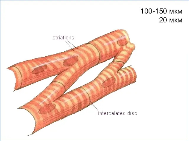 100-150 мкм 20 мкм