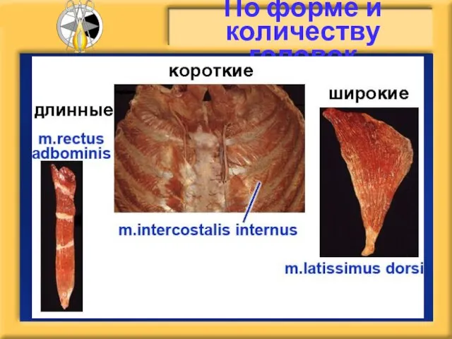 По форме и количеству головок Длинные Короткие Широкие