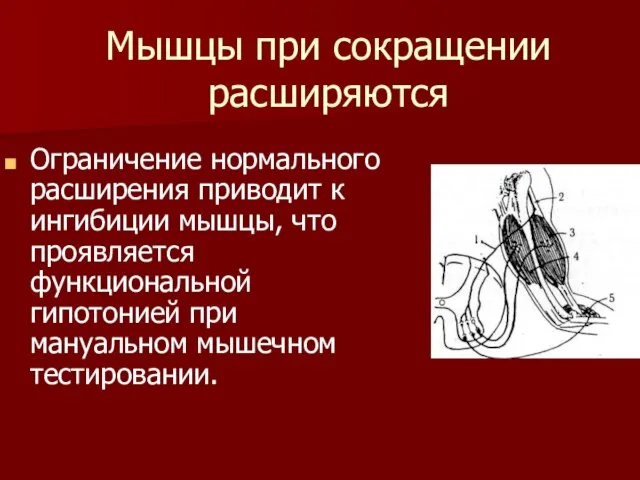 Мышцы при сокращении расширяются Ограничение нормального расширения приводит к ингибиции мышцы, что