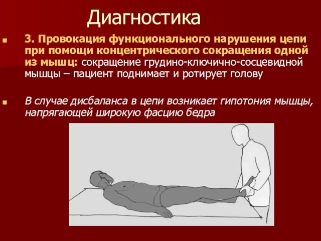 Диагностика 3. Провокация функционального нарушения цепи при помощи концентрического сокращения одной из