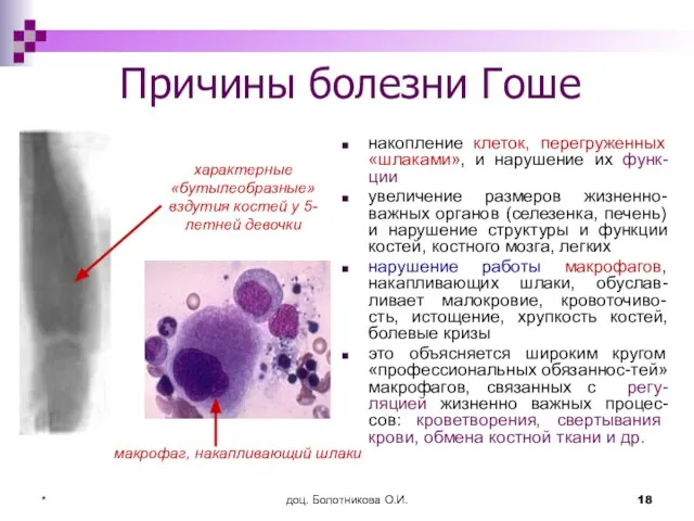 доц. Болотникова О.И. * Причины болезни Гоше накопление клеток, перегруженных «шлаками», и