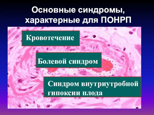 Основные синдромы, характерные для ПОНРП Болевой синдром Кровотечение Синдром внутриутробной гипоксии плода