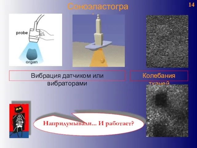 14 Соноэластография Колебания тканей Вибрация датчиком или вибраторами