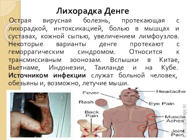 Лихорадка Денге Острая вирусная болезнь, протекающая с лихорадкой, интоксикацией, болью в мышцах