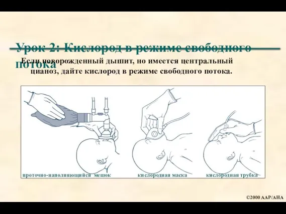 Урок 2: Кислород в режиме свободного потока Если новорожденный дышит, но имеется