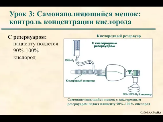 Урок 3: Самонаполняющийся мешок: контроль концентрации кислорода С резервуаром: пациенту подается 90%-100%