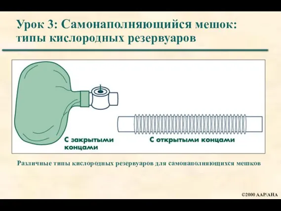 Урок 3: Самонаполняющийся мешок: типы кислородных резервуаров Различные типы кислородных резервуаров для самонаполняющихся мешков