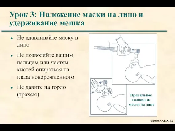 Урок 3: Наложение маски на лицо и удерживание мешка Не вдавливайте маску