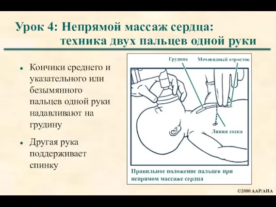 Урок 4: Непрямой массаж сердца: техника двух пальцев одной руки Кончики среднего