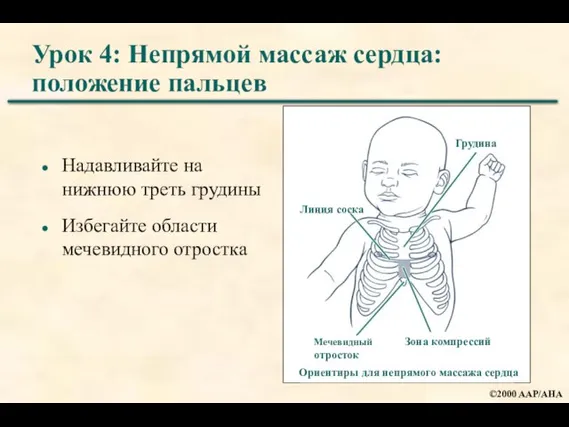 Урок 4: Непрямой массаж сердца: положение пальцев Надавливайте на нижнюю треть грудины