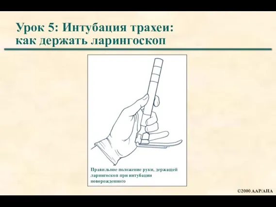 Урок 5: Интубация трахеи: как держать ларингоскоп Правильное положение руки, держащей ларингоскоп при интубации новорожденного
