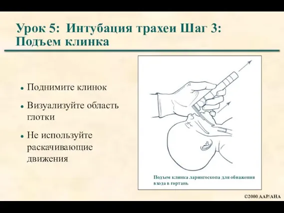 Урок 5: Интубация трахеи Шаг 3: Подъем клинка Поднимите клинок Визуализуйте область