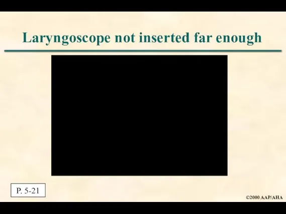 Laryngoscope not inserted far enough P. 5-21