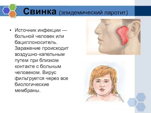 Свинка (эпидемический паротит) Источник инфекции — больной человек или бациллоноситель. Заражение происходит