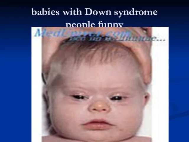 babies with Down syndrome people funny