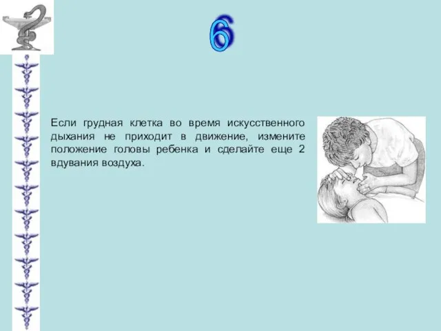 6 Если грудная клетка во время искусственного дыхания не приходит в движение,