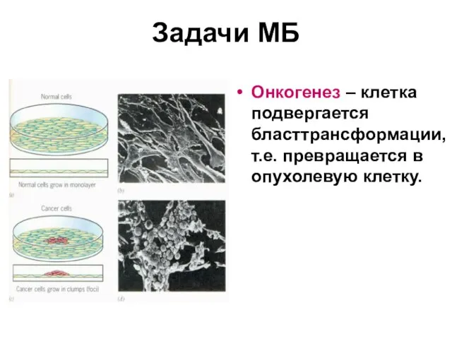 Задачи МБ Онкогенез – клетка подвергается бласттрансформации, т.е. превращается в опухолевую клетку.