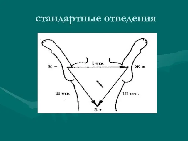 стандартные отведения