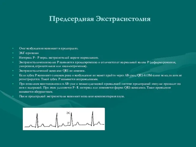 Предсердная Экстрасистолия Очаг возбуждения возникает в предсердиях. ЭКГ-признаки Интервал Р - Р