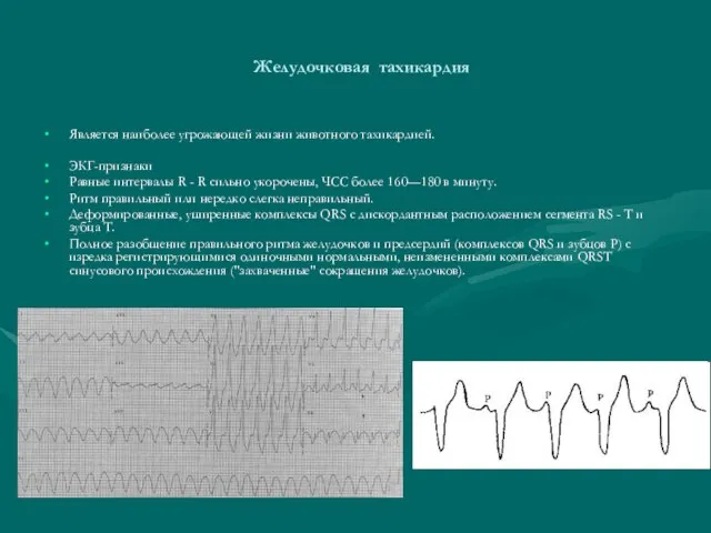 Желудочковая тахикардия Является наиболее угрожающей жизни животного тахикардией. ЭКГ-признаки Равные интервалы R