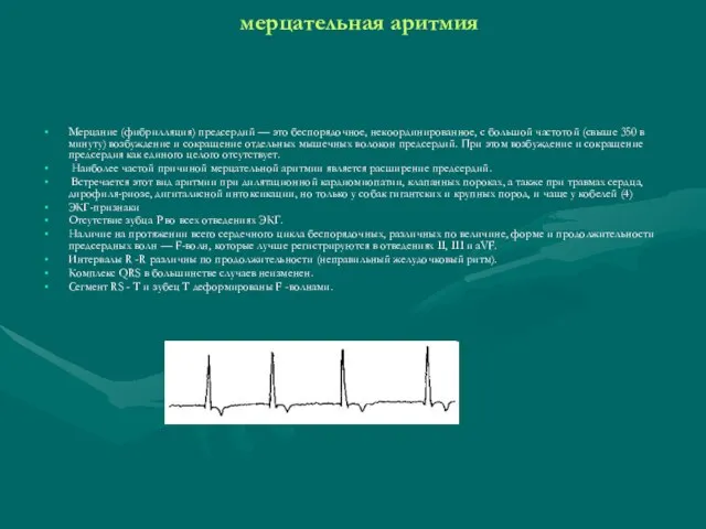 мерцательная аритмия Мерцание (фибрилляция) предсердий — это беспорядочное, некоординированное, с большой частотой