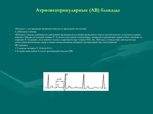 Атриовентрикулярные (АВ) блокады АВ-блокада — это нарушение проведения импульса от предсердий к