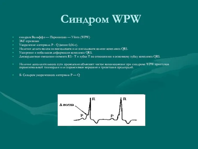 Синдром WPW синдром Вольффа — Паркинсона — Уйата (WPW) ЭКГ-признаки Укорочение интервала