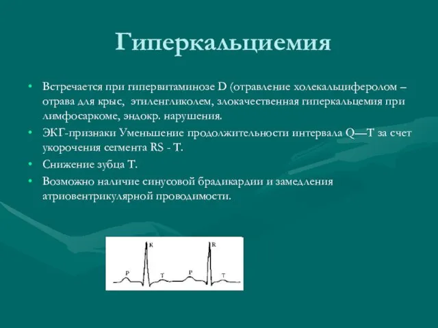 Гиперкальциемия Встречается при гипервитаминозе D (отравление холекальциферолом – отрава для крыс, этиленгликолем,