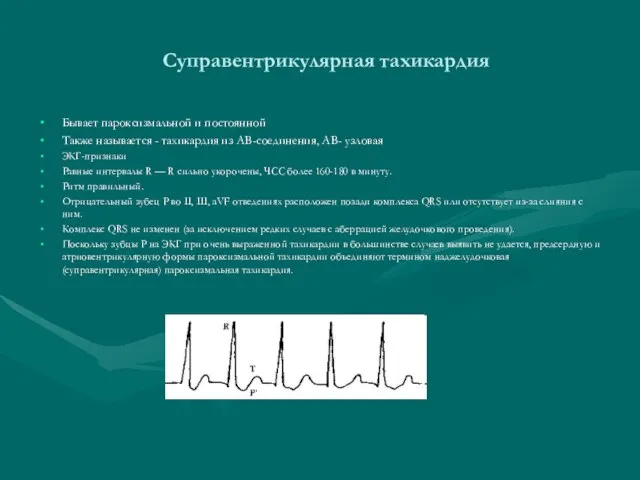 Суправентрикулярная тахикардия Бывает пароксизмальной и постоянной Также называется - тахикардия из АВ-соединения,