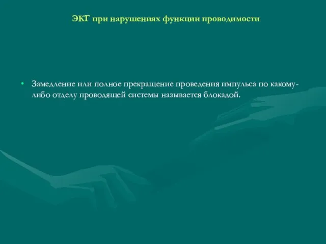 ЭКГ при нарушениях функции проводимости Замедление или полное прекращение проведения импульса по