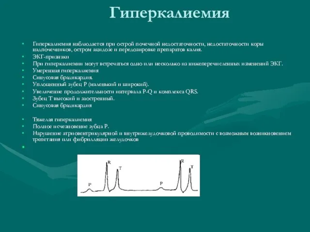 Гиперкалиемия Гиперкалиемия наблюдается при острой почечной недостаточности, недостаточности коры надпочечников, остром ацидозе