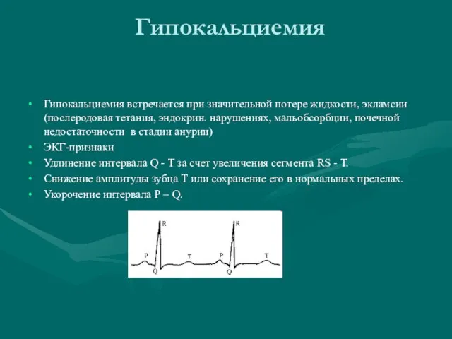 Гипокальциемия Гипокальциемия встречается при значительной потере жидкости, экламсии (послеродовая тетания, эндокрин. нарушениях,