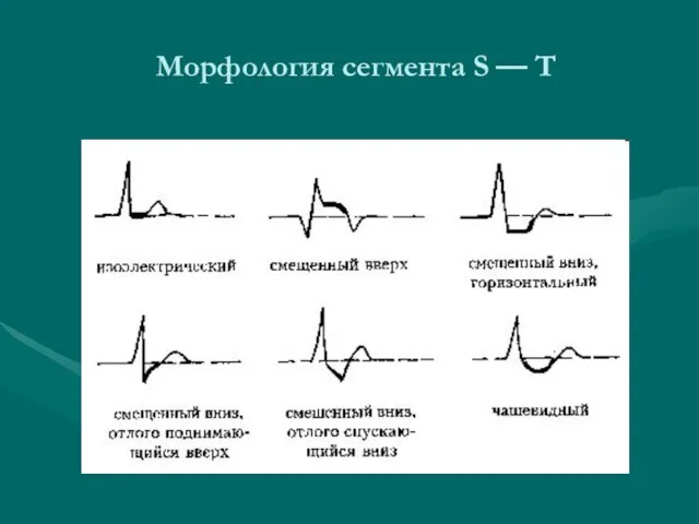 Морфология сегмента S — Т