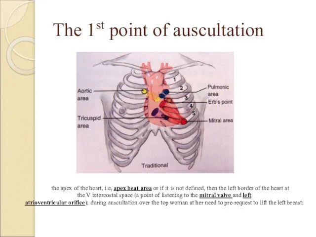 The 1st point of auscultation the apex of the heart, i.e, apex