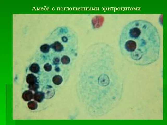 Амеба с поглощенными эритроцитами