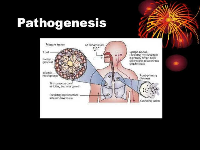 Pathogenesis