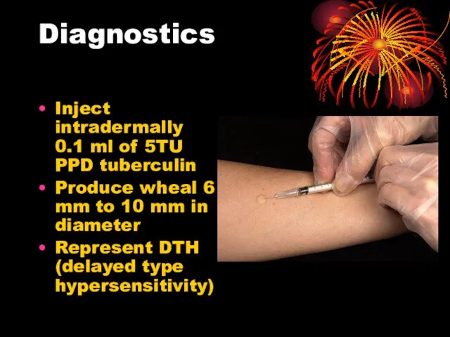 Diagnostics Inject intradermally 0.1 ml of 5TU PPD tuberculin Produce wheal 6