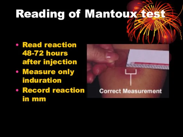 Reading of Mantoux test Read reaction 48-72 hours after injection Measure only