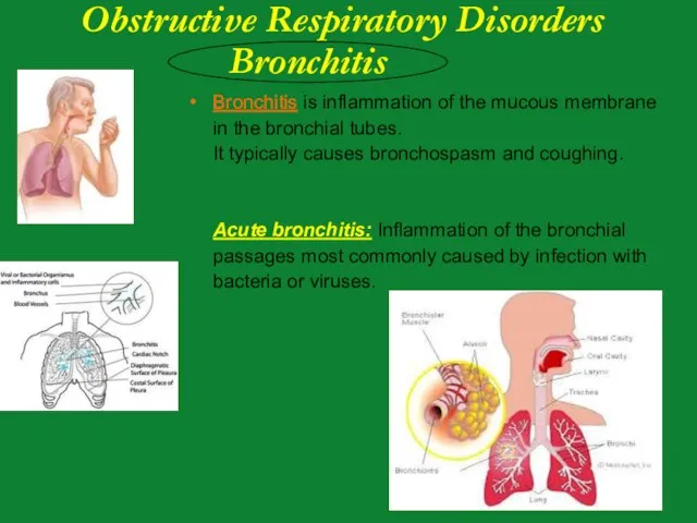 Bronchitis is inflammation of the mucous membrane in the bronchial tubes. It